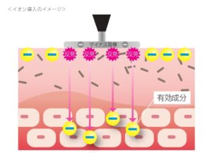 イオン導入のイメージ